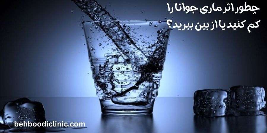 ترک اعتیاد بهوبدی کرج